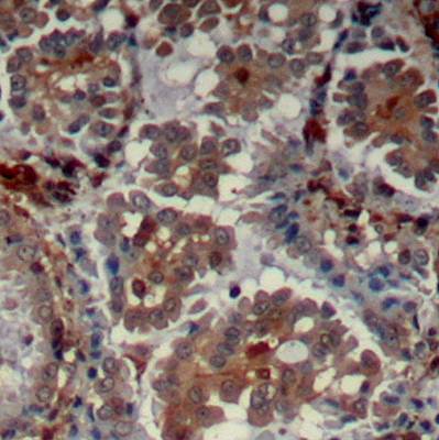 mTOR (Ab-2448) Antibody