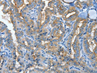MUC15 Antibody