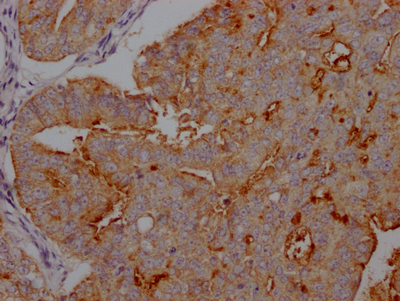 MUC16 Antibody