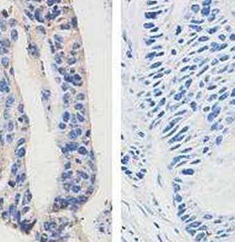 Mucin 16 Rabbit Polyclonal Antibody