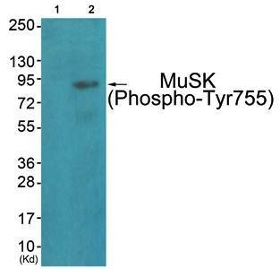 MuSK (Phospho-Tyr755) Antibody