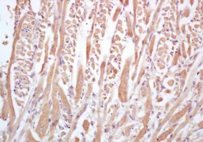 MUSK Rabbit Polyclonal Antibody