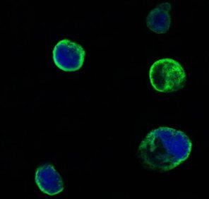MUSK Antibody