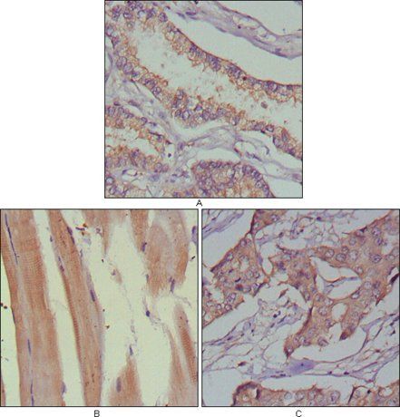 MUSK Antibody