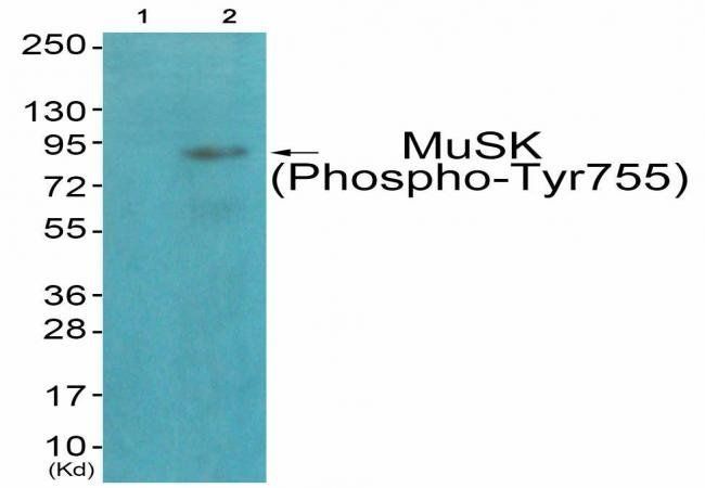 MuSK (Phospho-Tyr755) Antibody