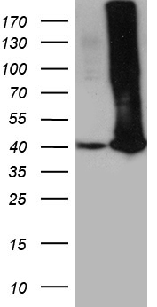 Mutarotase Antibody