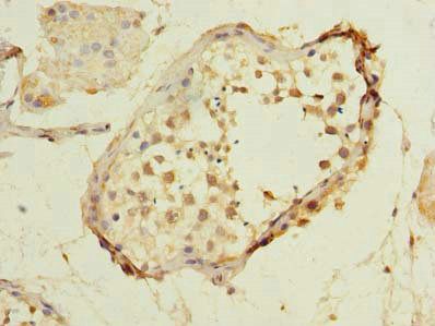MXD3 Antibody