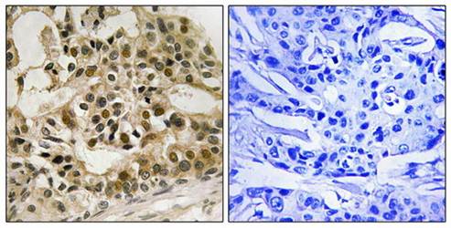 Myb (Phospho-Ser532) Antibody