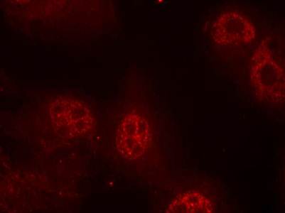Myc (Phospho-Ser62) Antibody