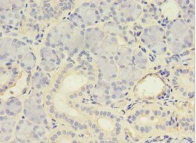 MYCBP Antibody