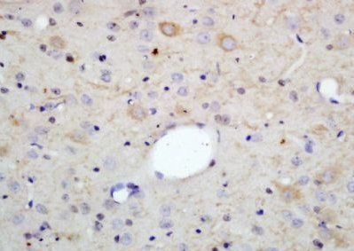 PLP1 Rabbit Polyclonal Antibody