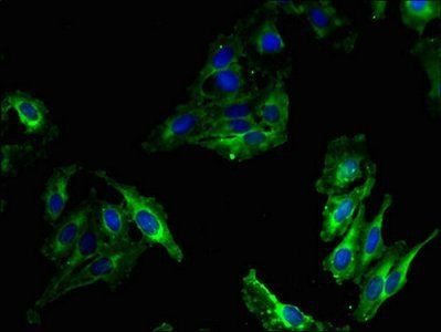 MPO Antibody