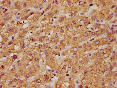 MPO Antibody