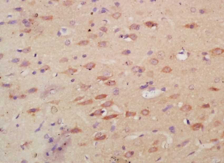 Myeloperoxidase Rabbit Polyclonal Antibody