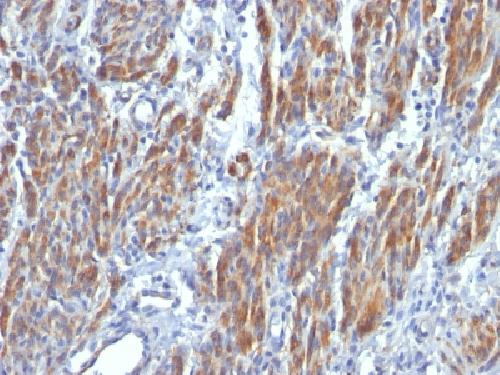 MYH11 Antibody