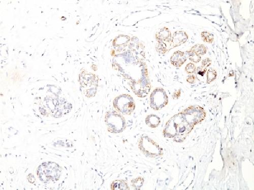 MYH11 Antibody