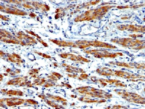 MYH11 Antibody