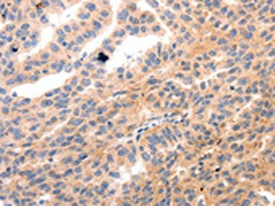 MYL9 Antibody