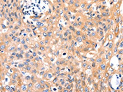 MYL9 Antibody