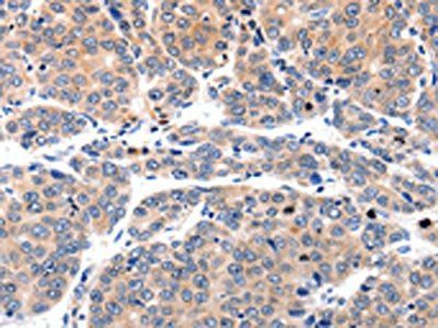 MYL9 Antibody
