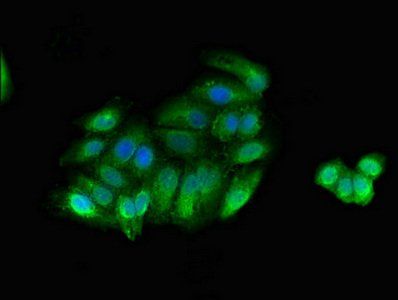 MYLK Antibody