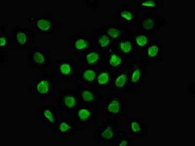 MYO18B Antibody
