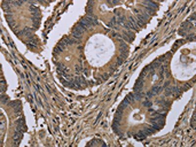MYO18B Antibody