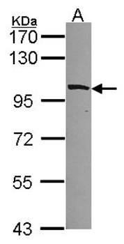 MYO1B Rabbit Polyclonal Antibody