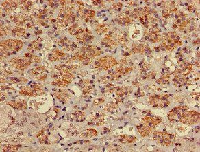 MYO7A Antibody