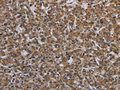MYO7A Antibody