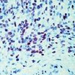 Mouse Human MyoD1 Antibody