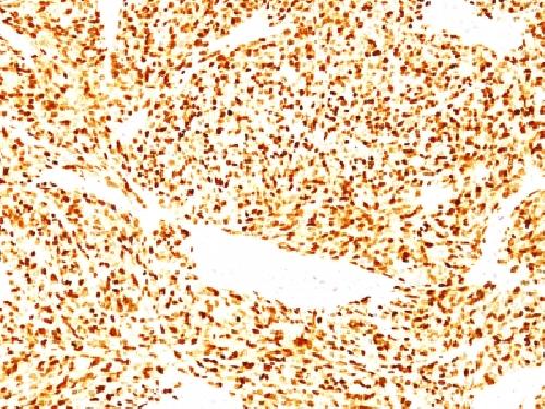 MYOD1 Antibody