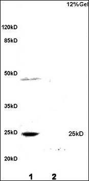 Myogenin Rabbit Polyclonal Antibody