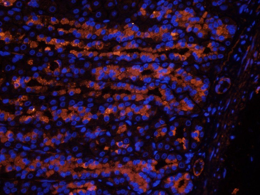 Myoglobin Rabbit Polyclonal Antibody