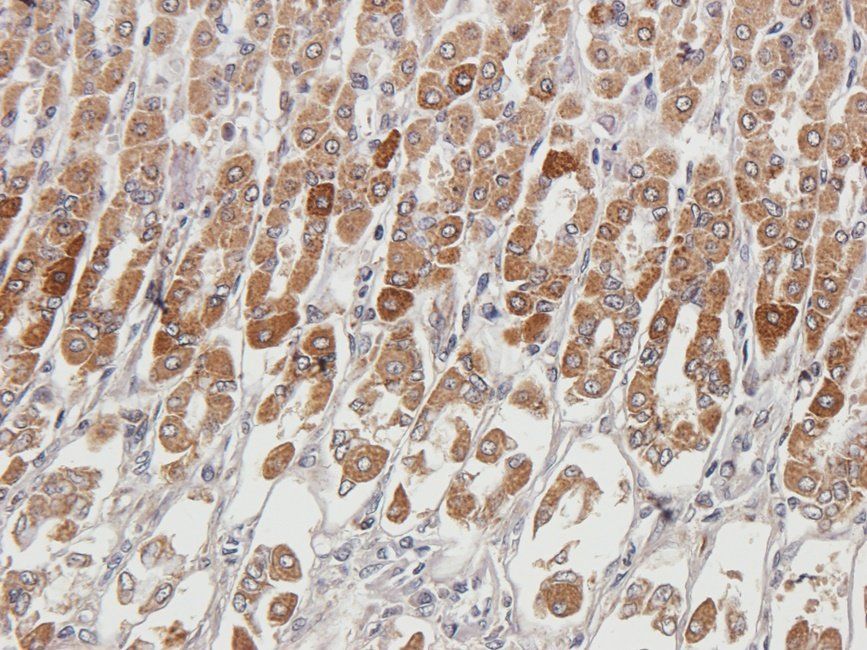 Myoglobin Rabbit Polyclonal Antibody