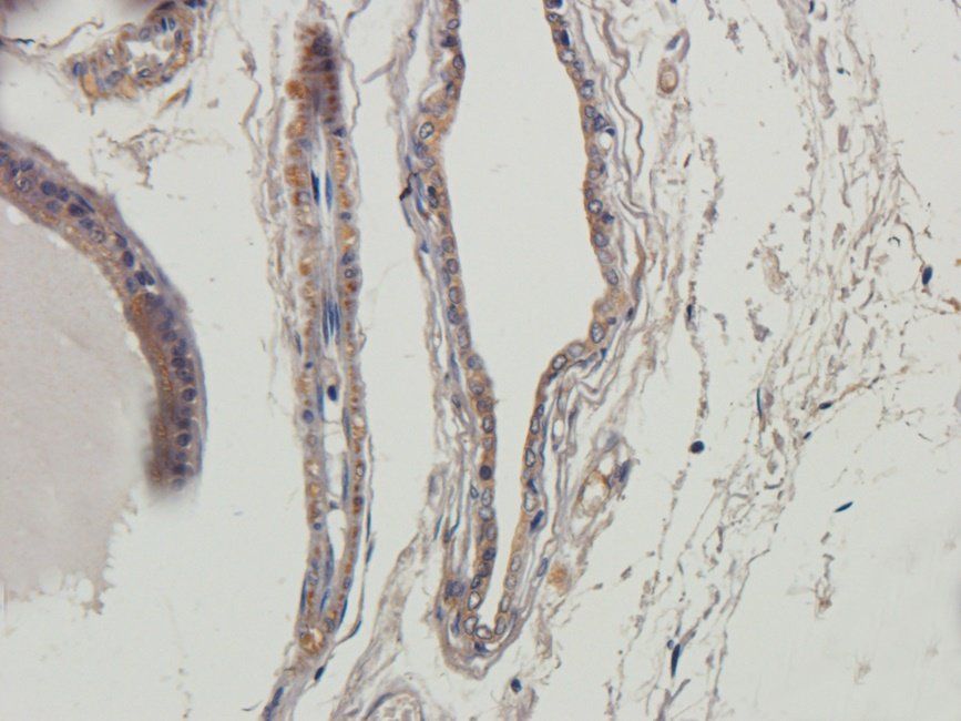 Myoglobin Rabbit Polyclonal Antibody
