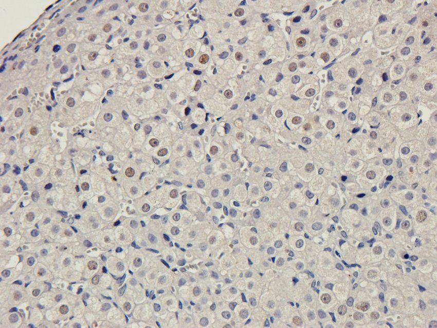 Myosin 3 Rabbit Polyclonal Antibody