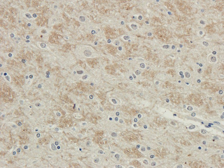 Myosin 3 Rabbit Polyclonal Antibody