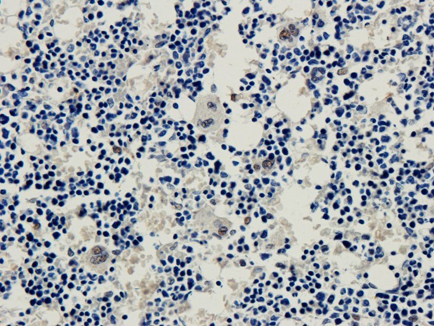 Myosin 3 Rabbit Polyclonal Antibody