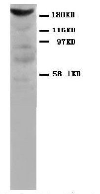 Myosin MYH2 Mouse Monoclonal Antibody