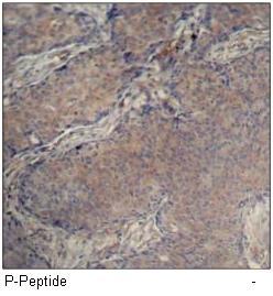 Myosin Light Chain 2 (Phospho-Ser19) Antibody