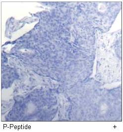 Myosin Light Chain 2 (Phospho-Ser19) Antibody