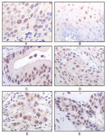 MYST1 Antibody