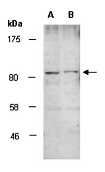 MYST2 (C1) Antibody, Rabbit Polyclonal