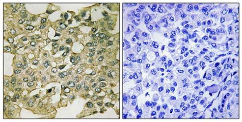 MYT1 (Phospho-Ser83) Antibody