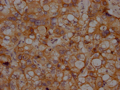 CDH2 Antibody