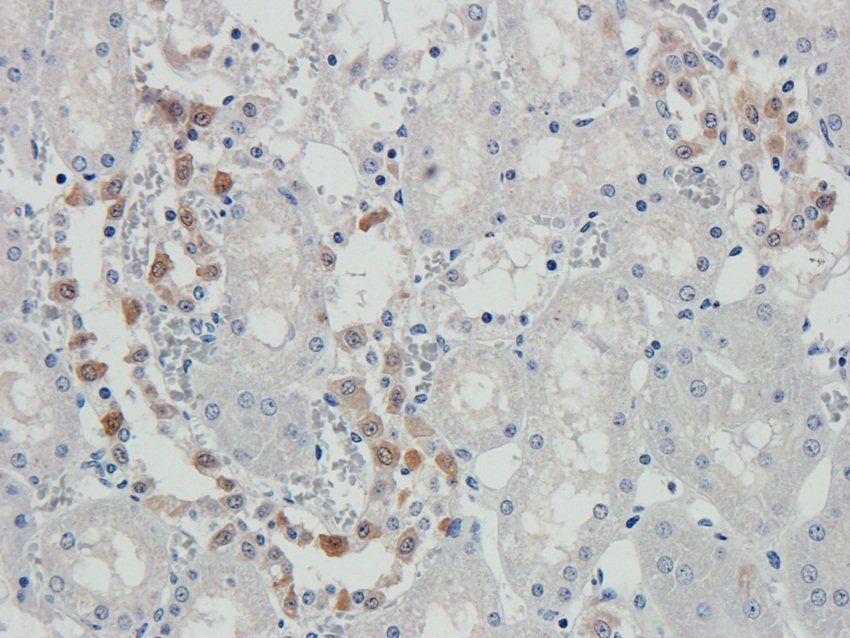 N Cadherin Rabbit Polyclonal Antibody