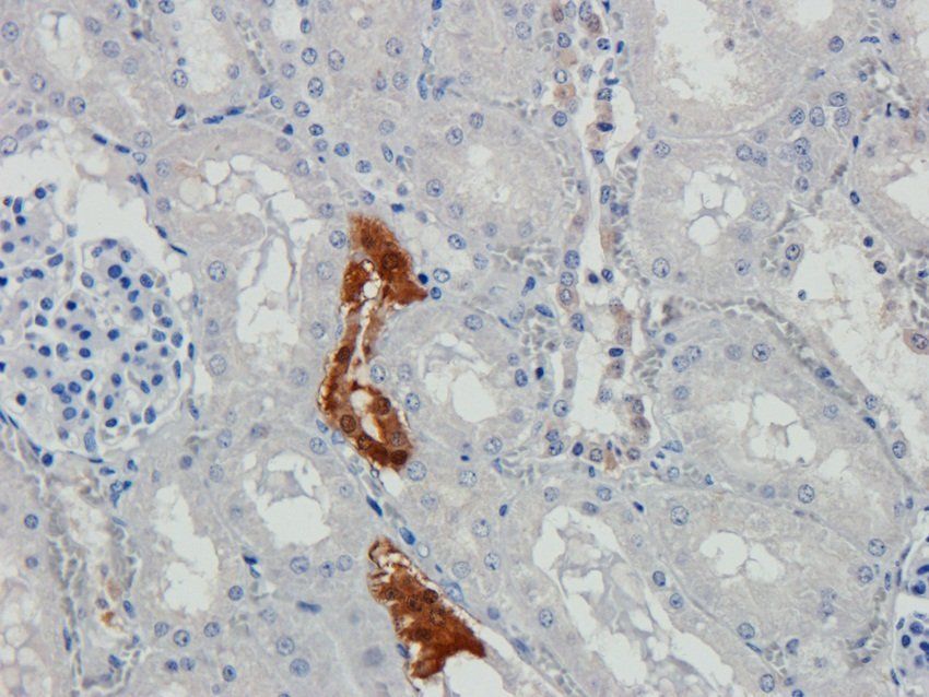 N Cadherin Rabbit Polyclonal Antibody