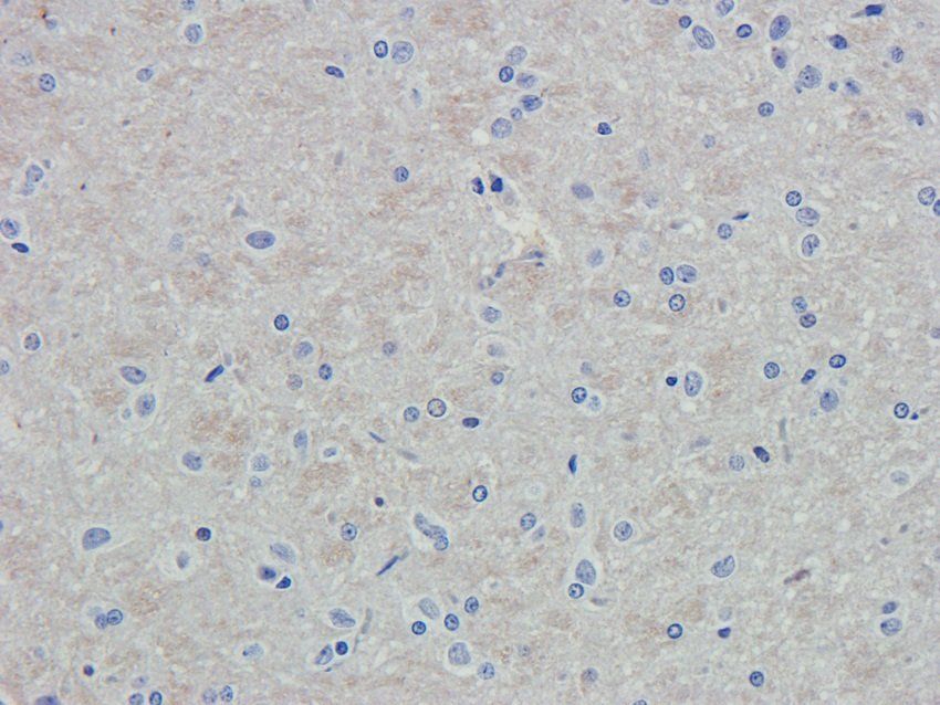 N Cadherin Rabbit Polyclonal Antibody
