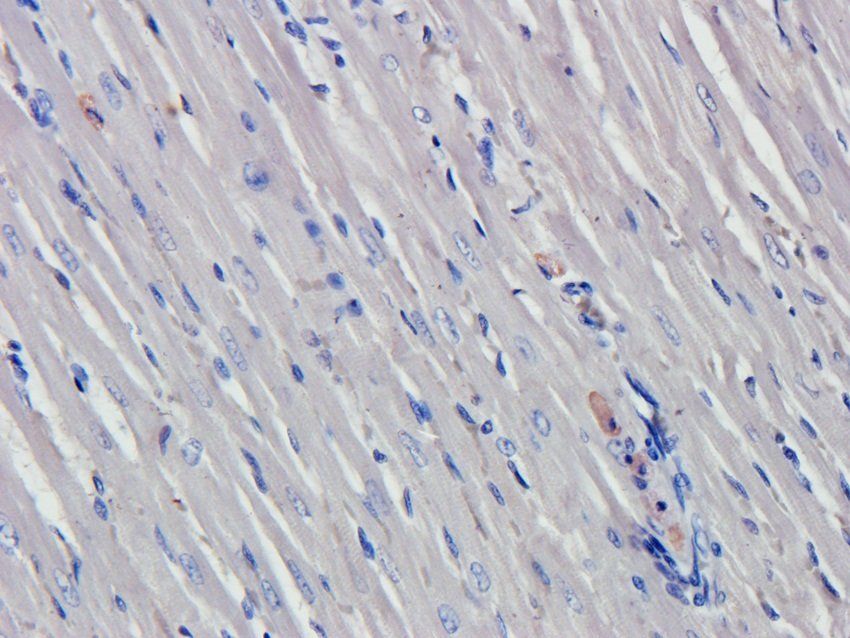 N Cadherin Rabbit Polyclonal Antibody